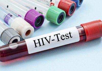 TEST NHANH ANTI HIV TẠI BVĐK THIỆU HÓA