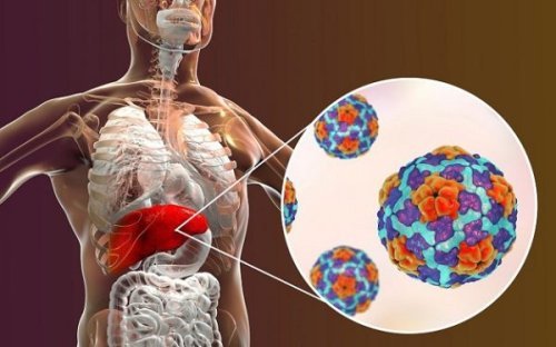UNG THƯ GAN Ở VIỆT NAM NGÀY CÀNG TRẺ HÓA, CÓ TRƯỜNG HỢP DƯỚI 30 TUỔI ĐÃ MẮC  BỆNH