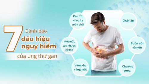snapedit_1701400904803.jpg