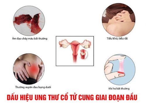 60fba27fa820ceecdedfc304_dau-hieu-ung-thu-co-tu-cung-giai-doan-dau (1).jpg