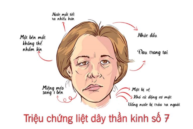 thuoc-uong-tri-liet-day-than-kinh-so-7-va-nhung-luu-y-1-1667790815801716038558.jpg