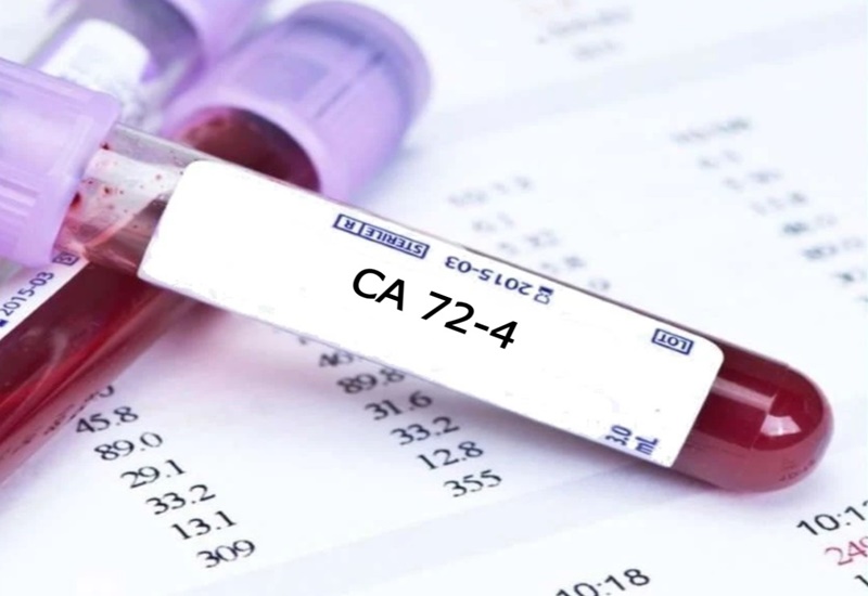 chi-so-CA-72-4-1.jpg