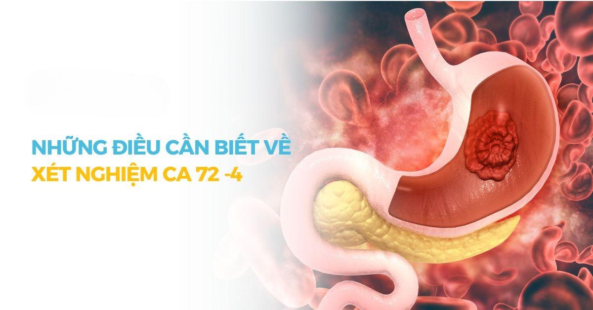 BVĐK THIỆU HÓA ỨNG DỤNG XÉT NGHIỆM CA 72-4 TRONG CHẨN ĐOÁN UNG THƯ DẠ DÀY
