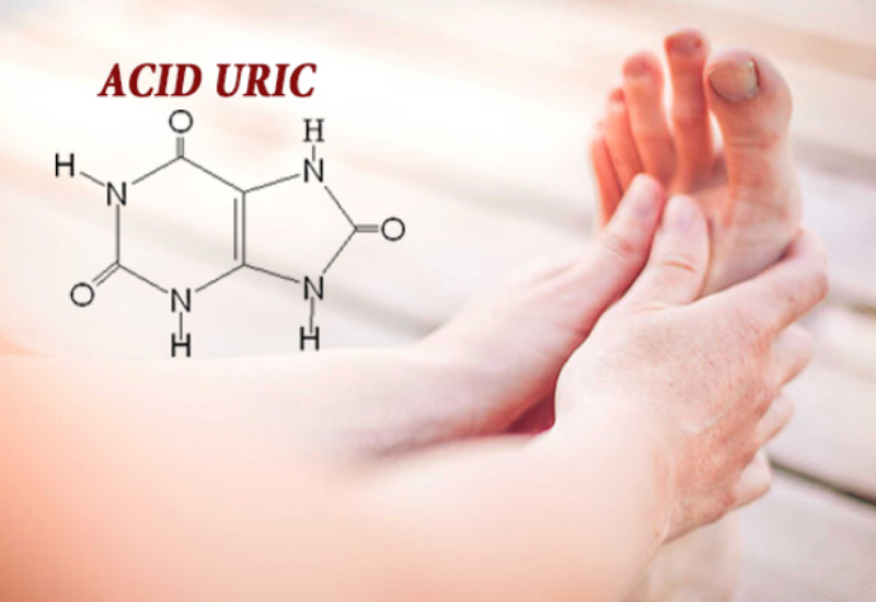 3 ĐIỀU CẦN BIẾT ĐỂ NGĂN CHẶN BỆNH GOUT