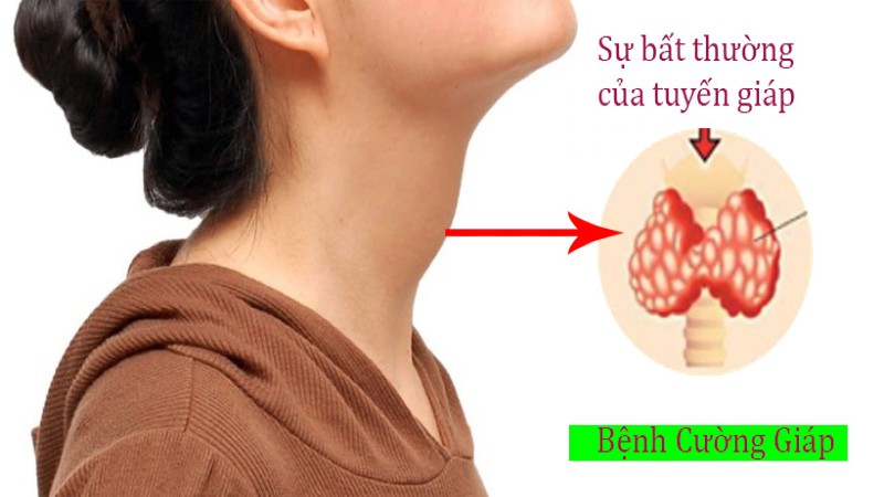  HIỂU HƠN VỀ BƯỚU CỔ ĐỂ XỬ LÝ BỆNH HIỆU QUẢ