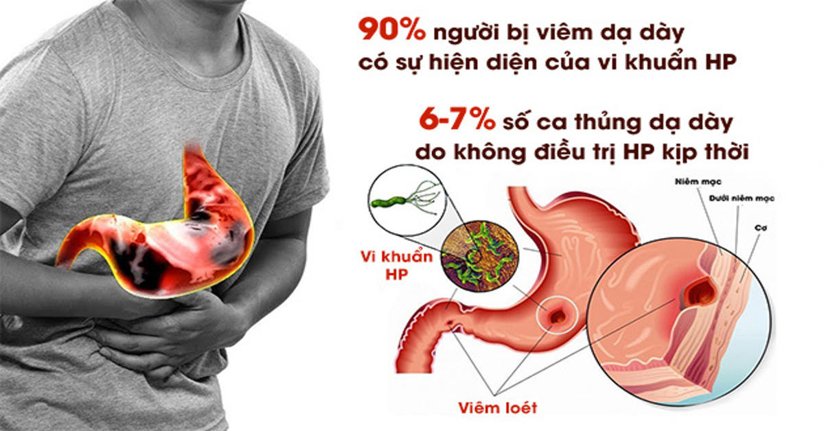 image.daidoanket.vn-images-upload-vanpt-12272020-_anh-bai-tren-fadc.jpg