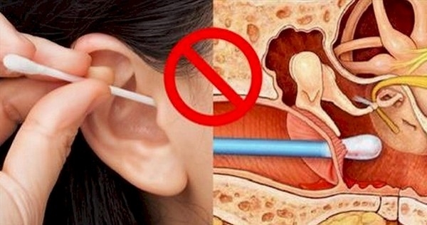  BÁC SĨ TƯ VẤN CÁCH VỆ SINH TAI ĐÚNG CÁCH