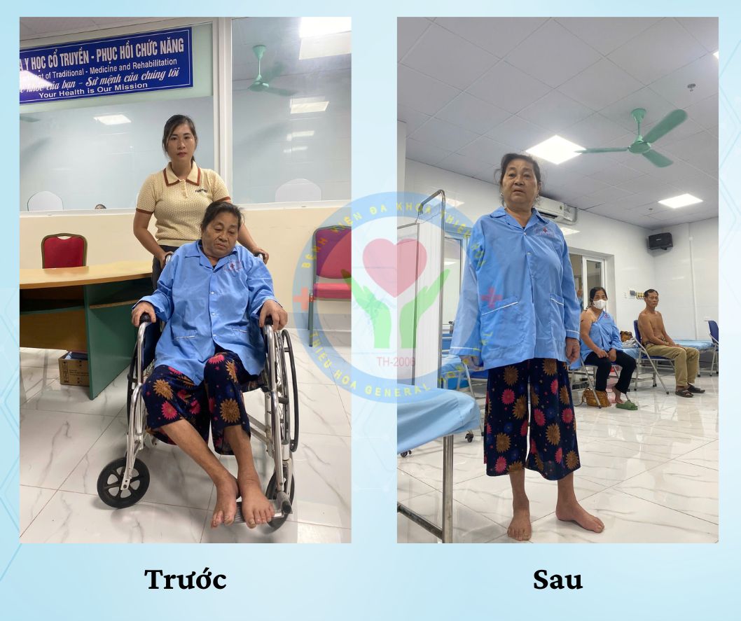 Thoát khỏi xe lăn nhờ điều trị hiệu quả tại Bệnh viện Đa khoa Thiệu Hóa